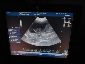 Echo van de dracht bij Dazzling Flash Zamba, januari 2026